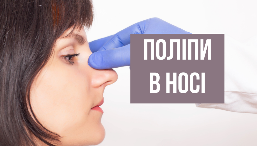 Поліпи в носі - Міжнародний медичний центр